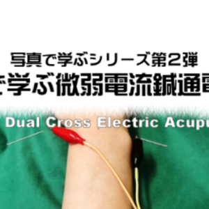 【写真で学ぶシリーズ第2弾・写真で学ぶMCEA療法】再現性のある低周波&微弱電流鍼通電療法の施術マニュアル【第4版】（Lasper-A・MC編/ピコリナ設定編）　レビュー